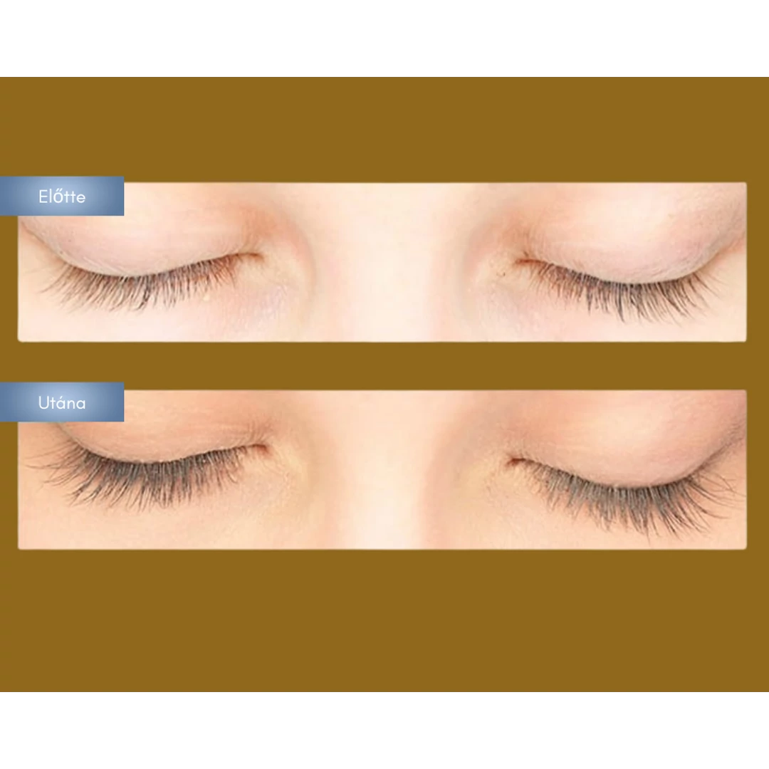 Ismerd meg a legjobb természetes pillanövesztő szérumokat!